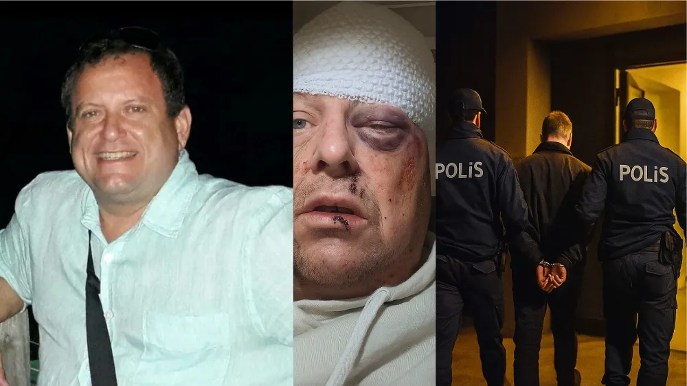 GAZETECİYE SALDIRIDA HARCANAN PARA 2 MİLYONA ÇIKTI!  